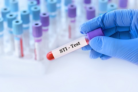 A person wearing blue latex gloves holds a test tube marked STI Test.