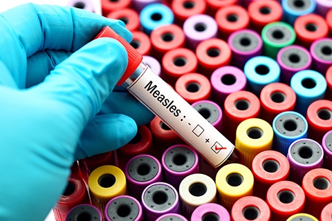 A gloved hand holds a vial marked 
