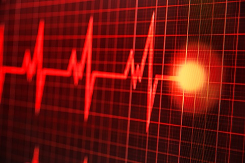 A heartbeat on a monitor.